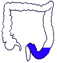 Sigmoid Colon